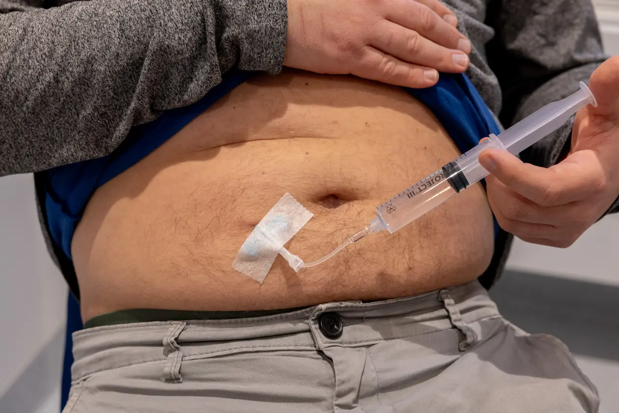 daratumubab injeksjon i mage