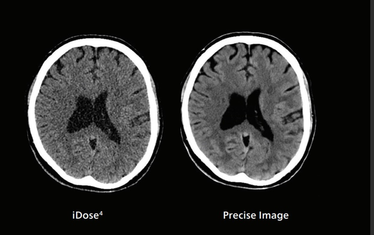 Noen få bilder av månen