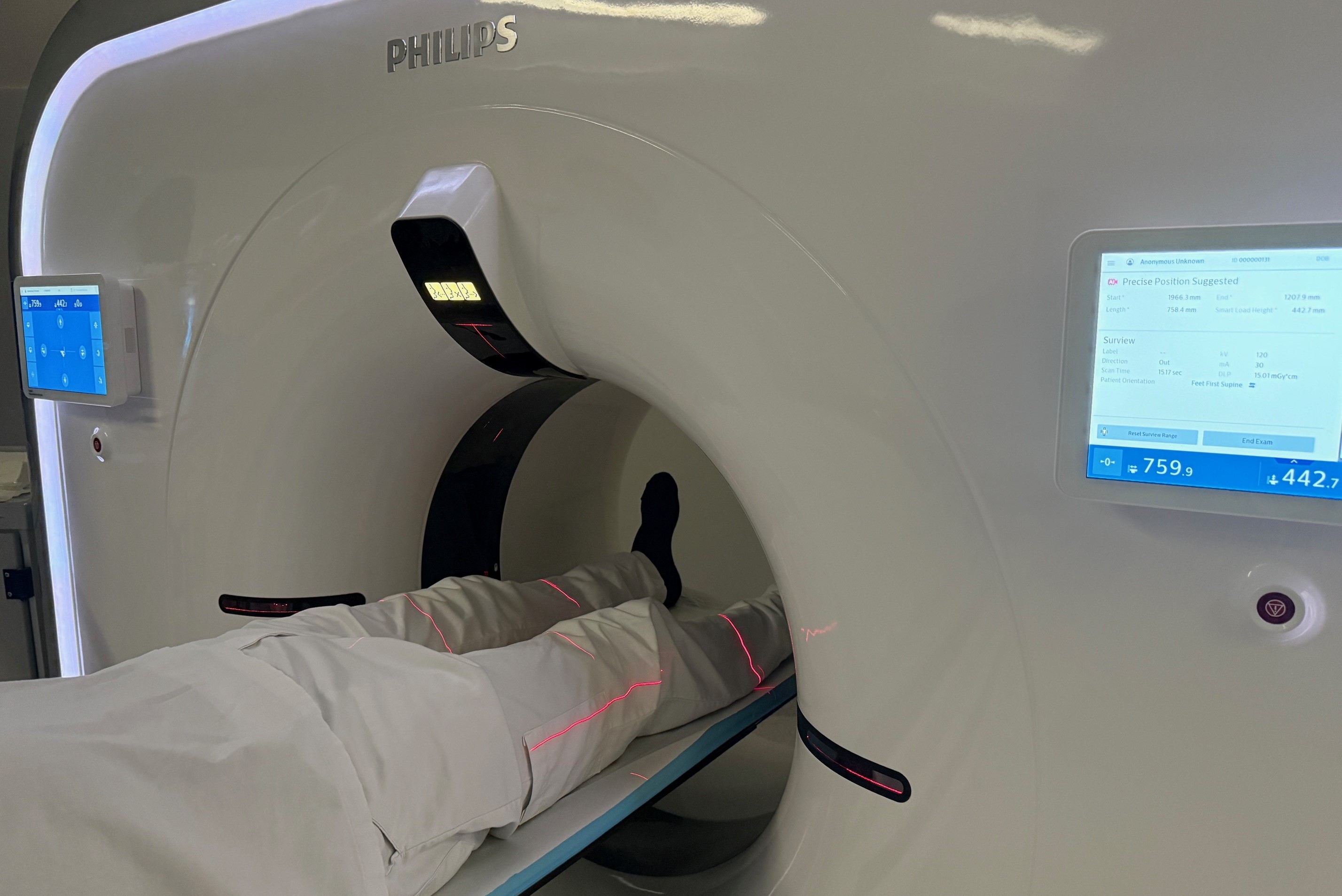 En persons ben i et bilsete