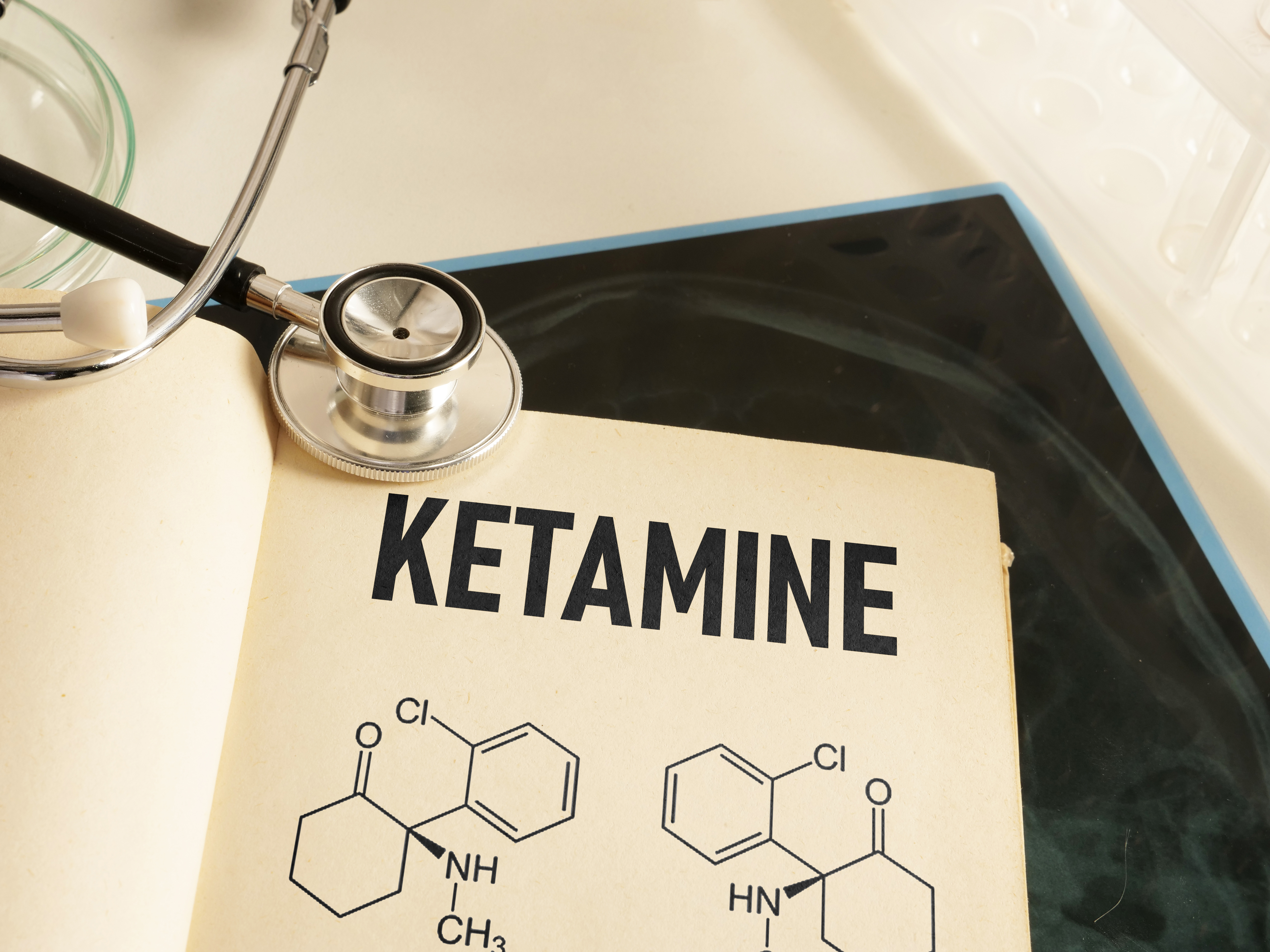 Illustrasjon: Ketamine