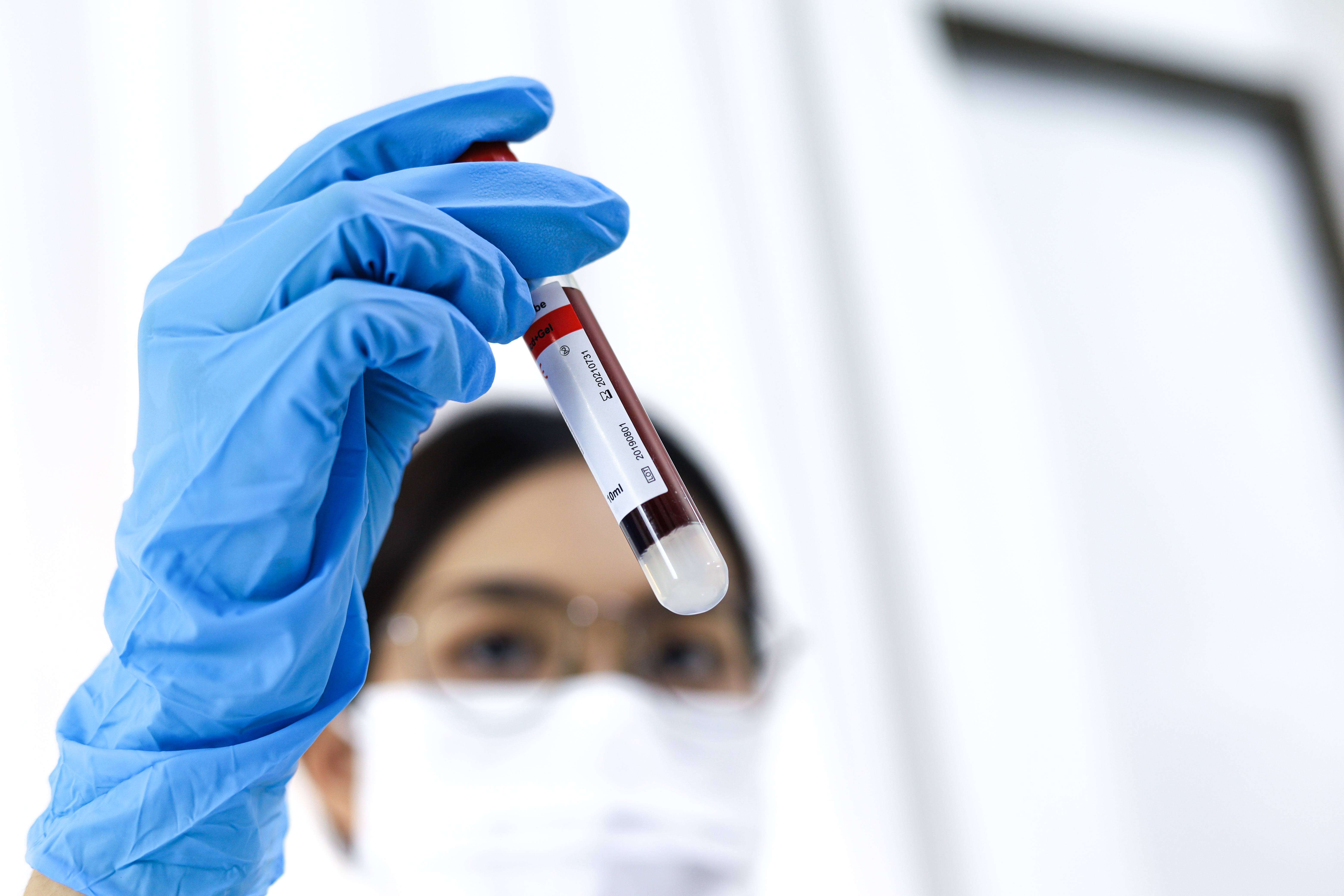 En bioingeniør som holder en blodprøve