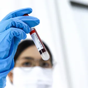 En bioingeniør som holder en blodprøve