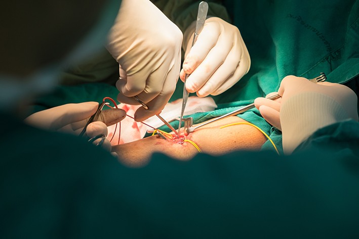 Karkirurgi operasjon