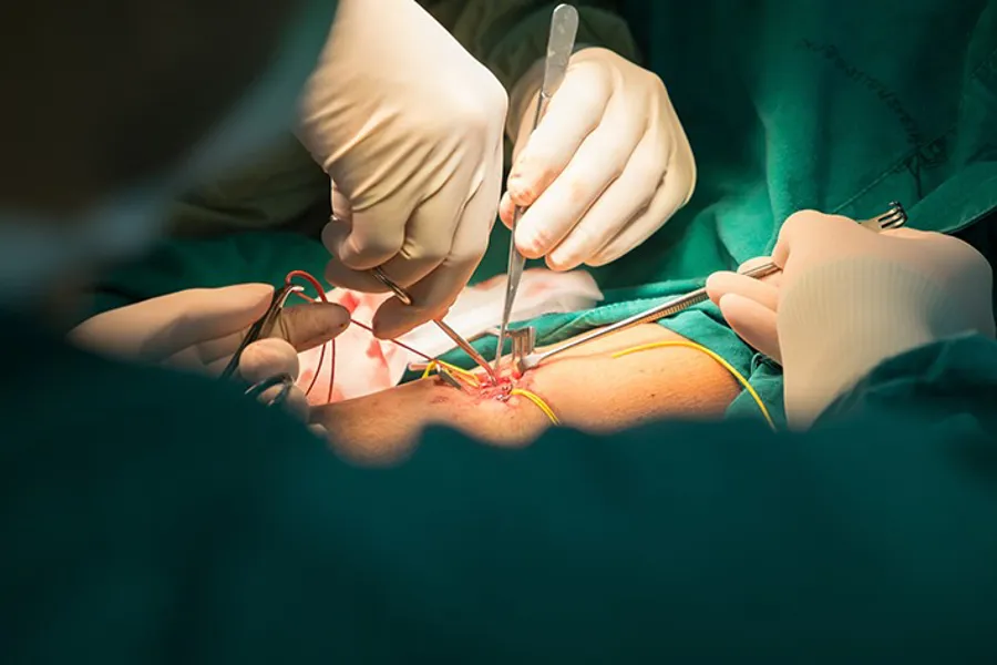 Karkirurgi operasjon